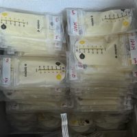 Oversupply of breast milk